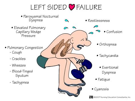 signs and symptoms of left sided heart failure.